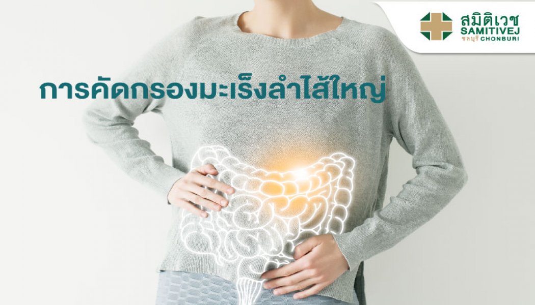 การคัดกรองมะเร็งลำไส้ใหญ่