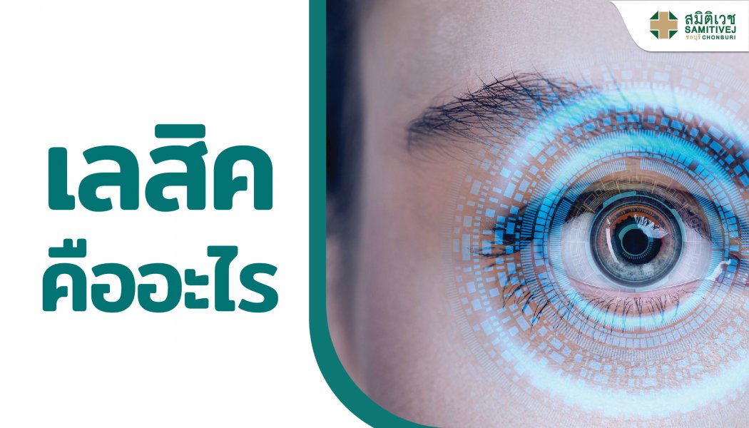 เลสิค (LASIK) คืออะไร ?