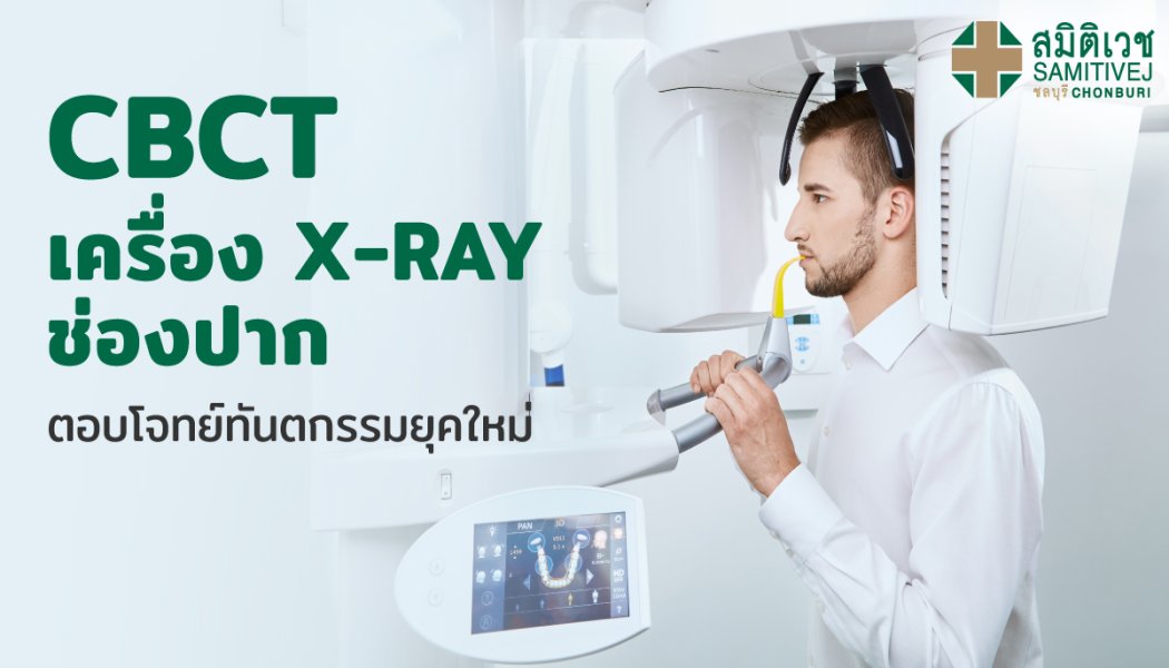 CBCT เครื่อง X-RAY ช่องปาก ตอบโจทย์ทันตกรรมยุคใหม่