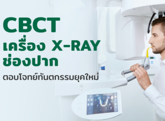 CBCT เครื่อง X-RAY ช่องปาก ตอบโจทย์ทันตกรรมยุคใหม่_2