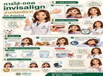 การใส่ และ ถอด Invisalign ง่ายนิดเดียว โดย หมอไนซ์ 