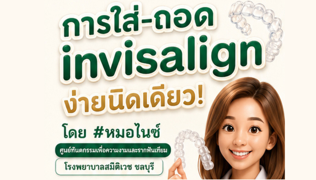 การใส่ และ ถอด Invisalign ง่ายนิดเดียว โดย หมอไนซ์ 
