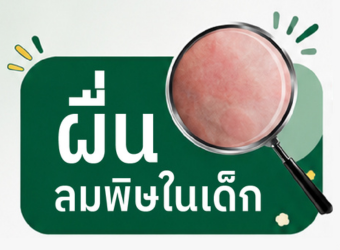 ผื่นลมพิษในเด็ก_2