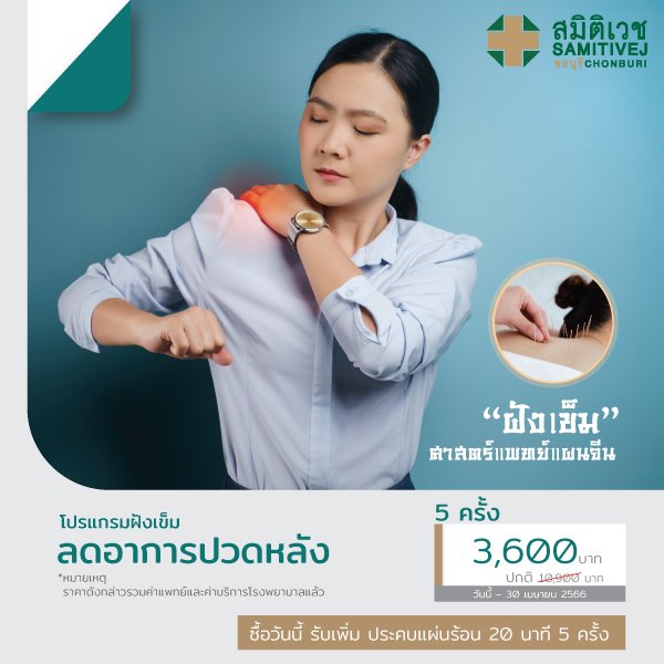 โปรแกรมฝังเข็มลดอาการปวดหลัง 5 ครั้ง