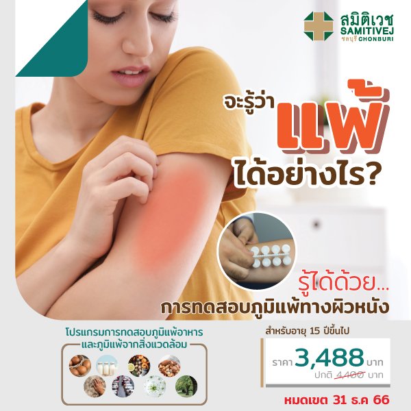 Skin Prick Test