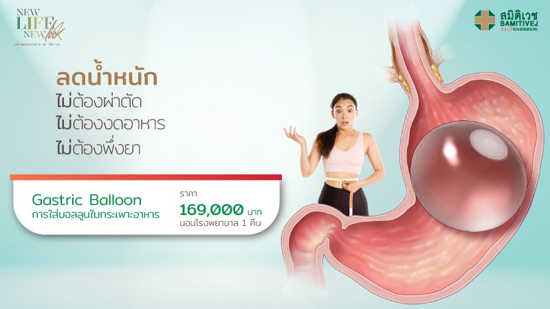 Gastric Balloon
