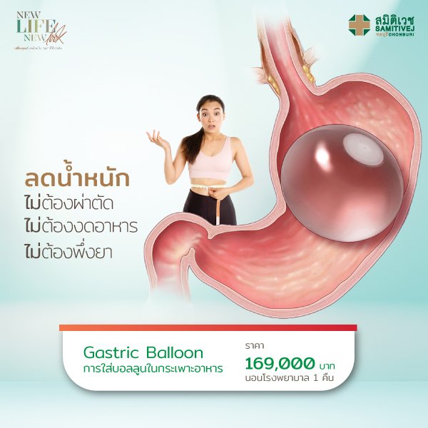 แพ็กเกจ Gastric Balloon ใส่บอลลูนในกระเพาะอาหาร
