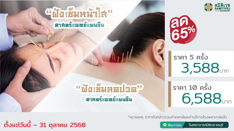 Acupuncture  for Health and beauty