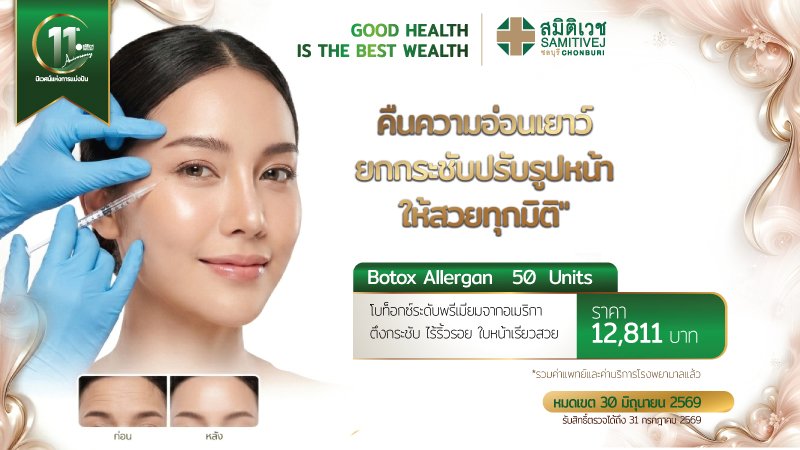 BOTOX  Allergan 50 unit ปรับรูปหน้า ลดริ้วรอย หน้าเรียว