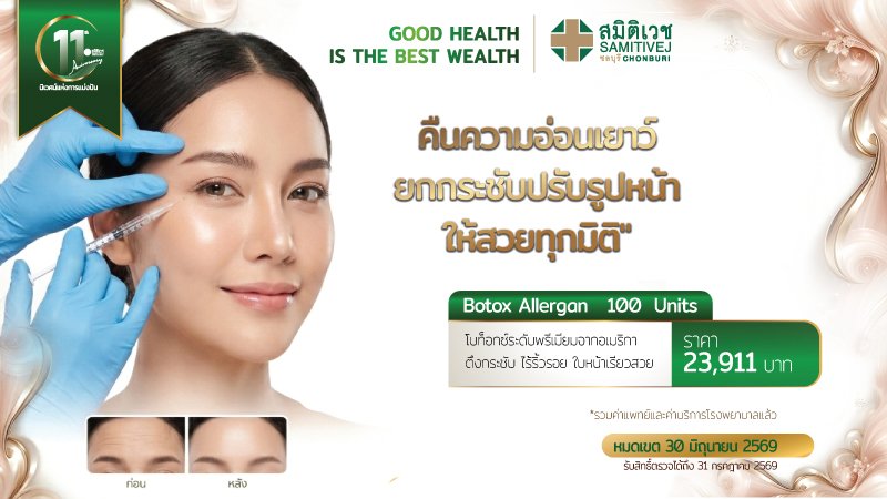 BOTOX Allergan 100 unit ปรับรูปหน้า ลดริ้วรอย หน้าเรียว