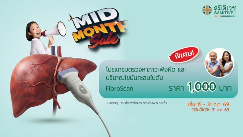 Mid Month : ตรวจภาวะพังผืดในเนื้อตับและไขมันพอกตับ ด้วยเครื่องไฟโบรสแกน (Fibro scan)