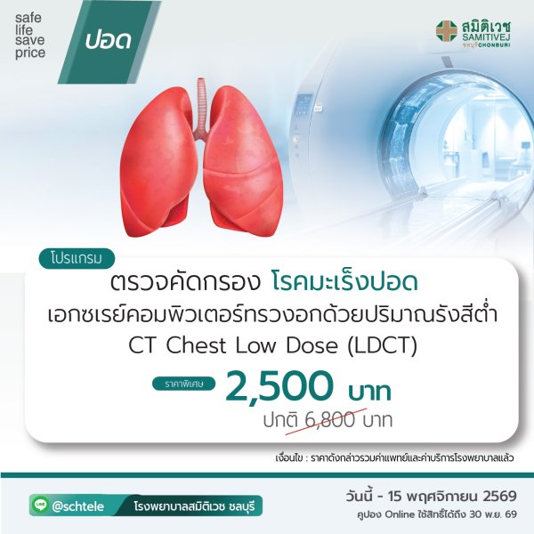 ตรวจคัดกรองมะเร็งปอดด้วย Low-dose CT Chest screening
