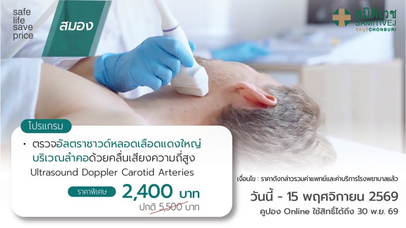 ตรวจ คัดกรองความเสี่ยงภาวะโรคหลอดเลือดสมอง : Carotid Doppler Ultrasound
